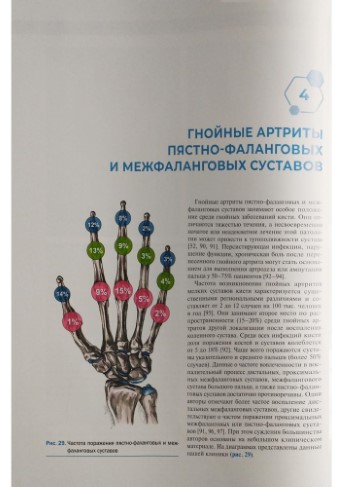 Гнойная-хирургия-кисти-0004.jpg Гнойная-хирургия-кисти-0004.jpg